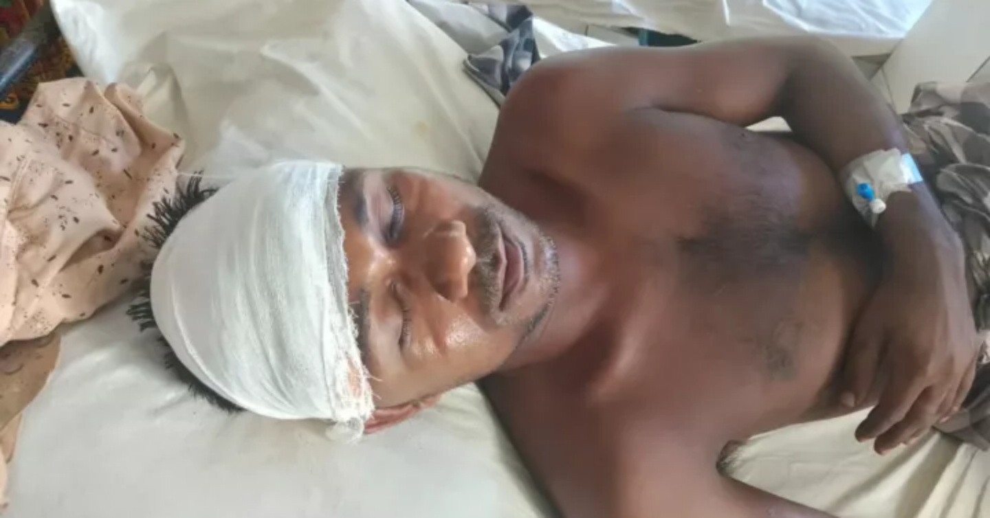 জগন্নাথপুরে অতর্কিত হামলায় মৎস্যজীবি দুই যুবক আহত, থানায় অভিযোগ
