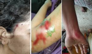 বানরের দাপট সিলেট কৃষি বিশ্ববিদ্যালয়ে, শতাধিক ছাত্রী আহত