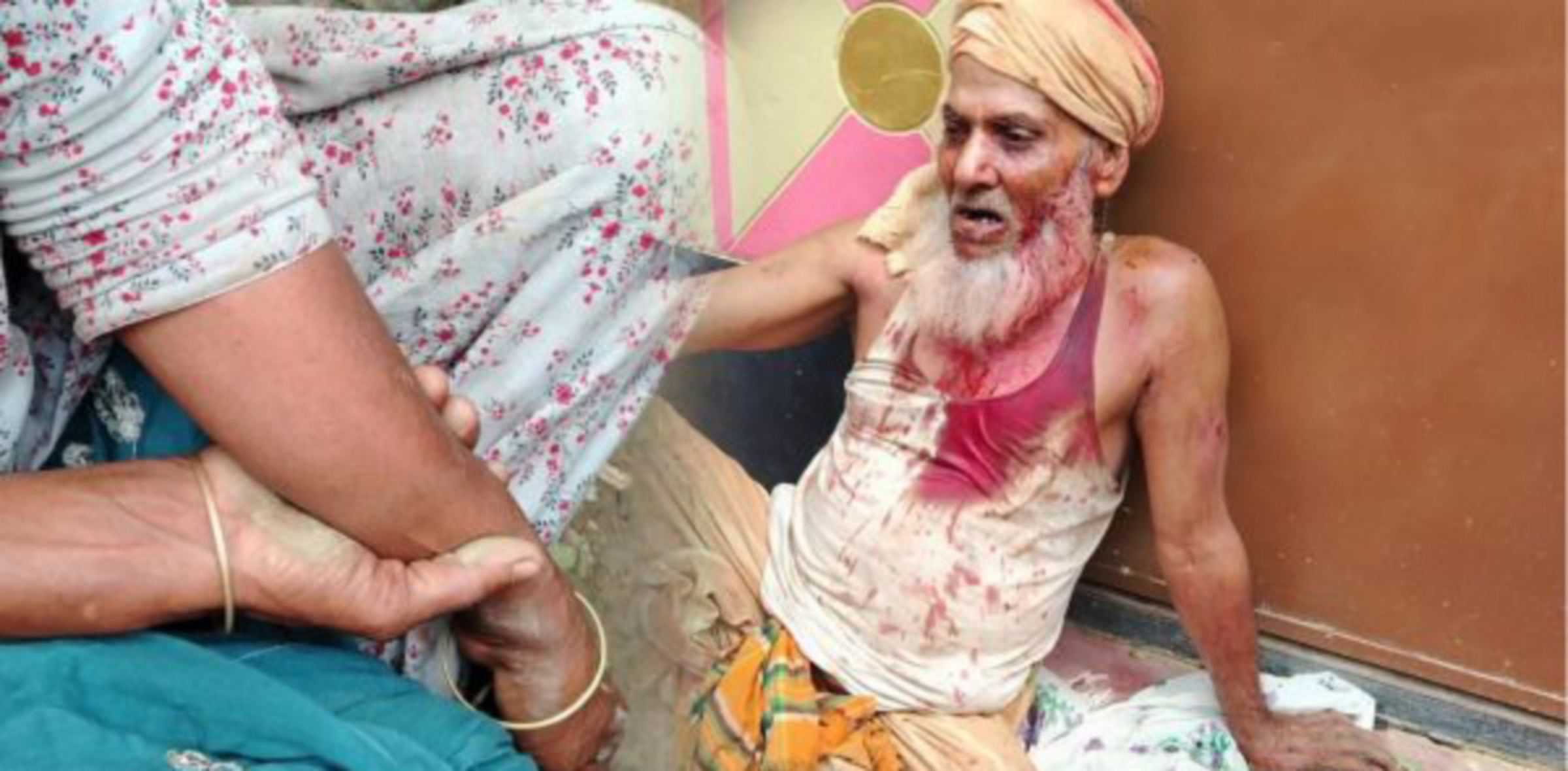 জগন্নাথপুরে কলাগাছ পড়াকে কেন্দ্র করে হামলায় মহিলা সহ ৫ জন আহত