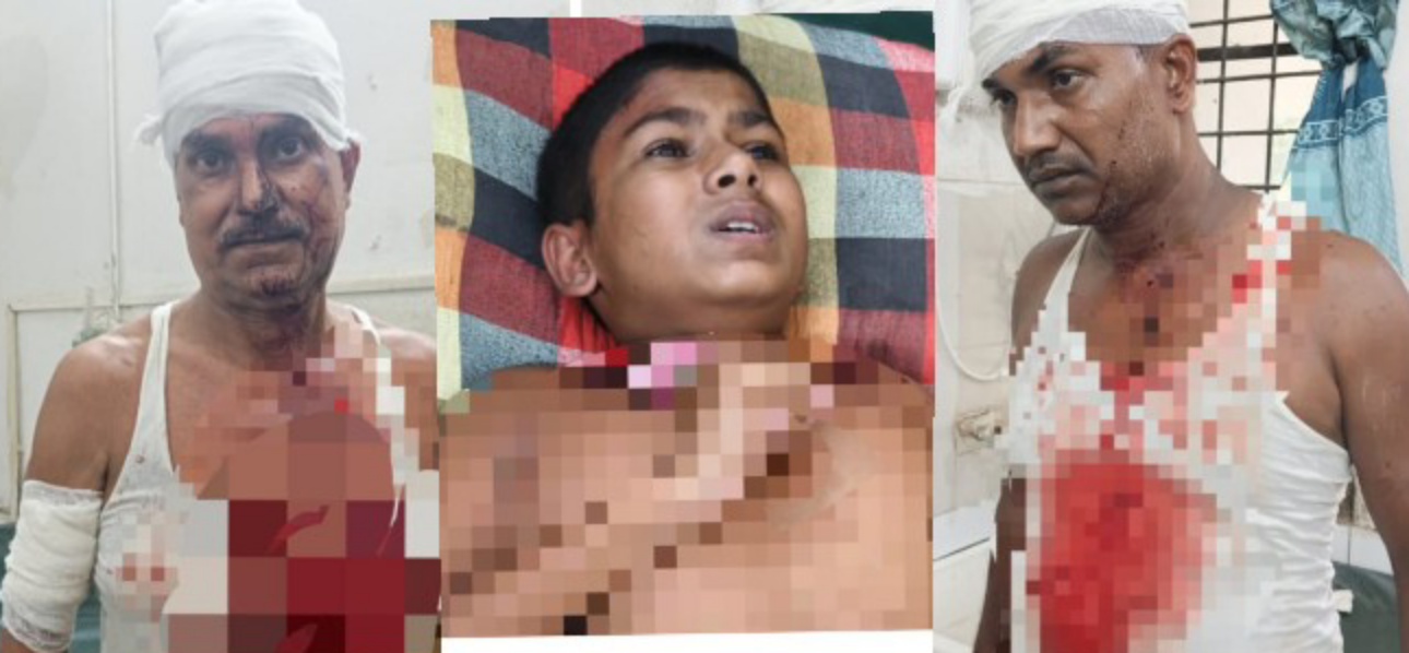 জৈন্তাপুরে দেবোত্তর সম্পত্তি জোরপূর্বক দখলের চেষ্টায় প্রতিপক্ষের উপর অর্তকিত হামলায় ৫জন গুরুত্বর আহত