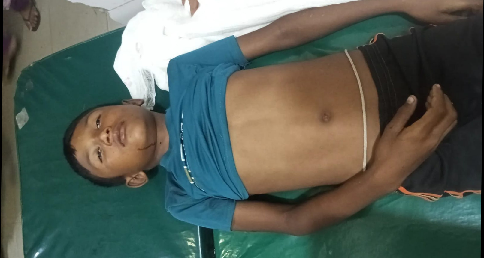 সুনামগঞ্জে অটোরিকশার ধাক্কায় এক স্কুল শিক্ষার্থী নিহত