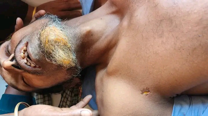 জগন্নাথপুরে মাছ ধরাকে কেন্দ্র করে সংঘর্ষে ১ জন নিহ ও ১১ জন আহত